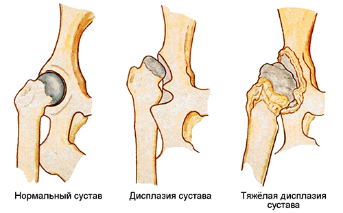 Фигурата илюстрира тежестта на заболяването